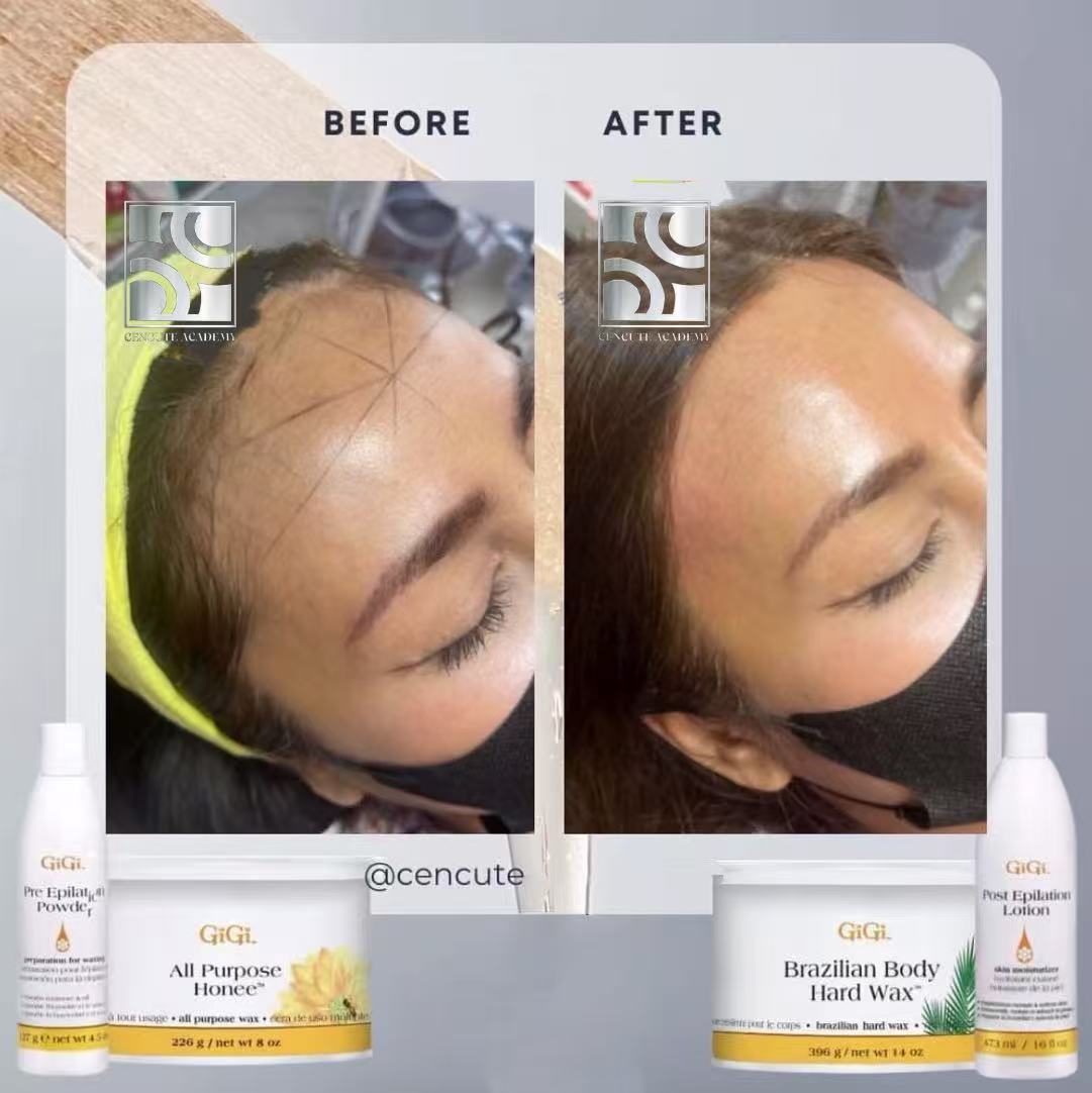 แวกซ์ขนไรผม/หน้าผาก ก่อน–หลัง · Cencute Studio นนทบุรี